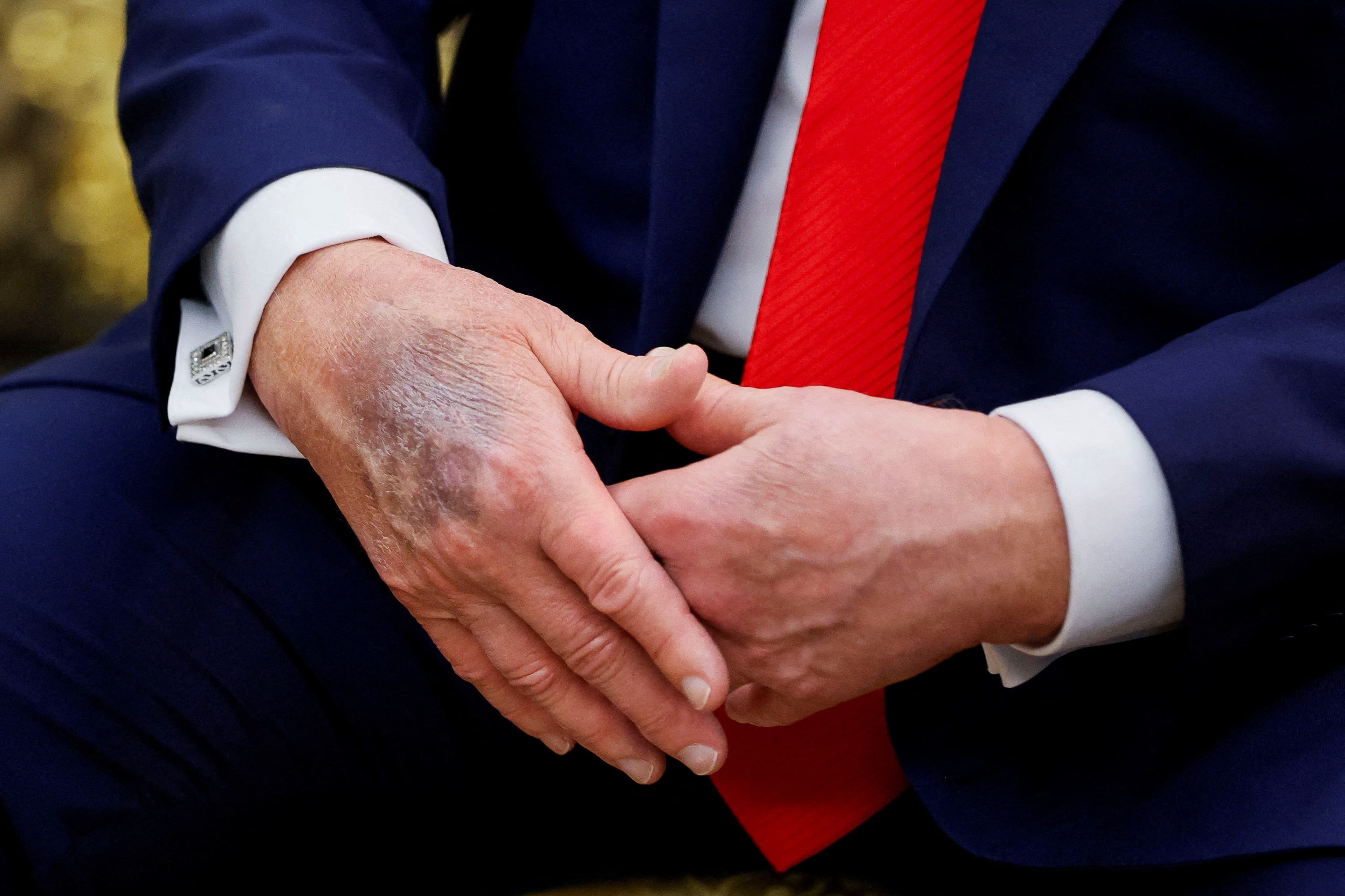 Статья Умер ли Дональд Трамп